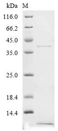 (Tris-Glycine gel) Discontinuous SDS-PAGE (reduced) with 5% enrichment gel and 15% separation gel.