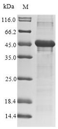 (Tris-Glycine gel) Discontinuous SDS-PAGE (reduced) with 5% enrichment gel and 15% separation gel.