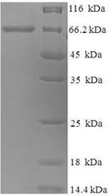 Recombinant Canine distemper virus Fusion glycoprotein F0 (F), partial – Figure 1 of 1