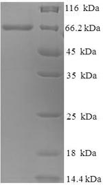 Recombinant Canine distemper virus Fusion glycoprotein F0 (F), partial – Figure 1 of 1