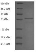 Recombinant Epstein-Barr virus Latent membrane protein 1 (LMP1), partial – Figure 1 of 1