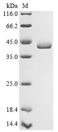 (Tris-Glycine gel) Discontinuous SDS-PAGE (reduced) with 5% enrichment gel and 15% separation gel.