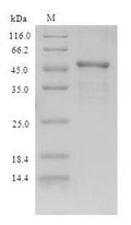 Recombinant Rhodobacter sphaeroides Modification methylase RsrI (rsrIM) – Figure 1 of 1