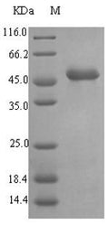 (Tris-Glycine gel) Discontinuous SDS-PAGE (reduced) with 5% enrichment gel and 15% separation gel.