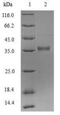 (Tris-Glycine gel) Discontinuous SDS-PAGE (reduced) with 5% enrichment gel and 15% separation gel.