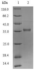 (Tris-Glycine gel) Discontinuous SDS-PAGE (reduced) with 5% enrichment gel and 15% separation gel.