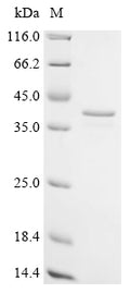(Tris-Glycine gel) Discontinuous SDS-PAGE (reduced) with 5% enrichment gel and 15% separation gel.