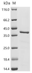 (Tris-Glycine gel) Discontinuous SDS-PAGE (reduced) with 5% enrichment gel and 15% separation gel.