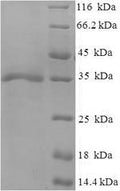 Recombinant Human cytomegalovirus Envelope glycoprotein H (gH), partial – Figure 1 of 1