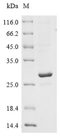(Tris-Glycine gel) Discontinuous SDS-PAGE (reduced) with 5% enrichment gel and 15% separation gel.
