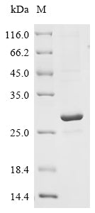 (Tris-Glycine gel) Discontinuous SDS-PAGE (reduced) with 5% enrichment gel and 15% separation gel.