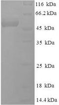 Recombinant Epstein-Barr virus Deoxyuridine 5'-triphosphate nucleotidohydrolase (BLLF3) – Figure 1 of 1