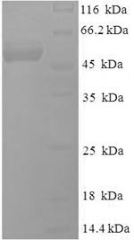 Recombinant Epstein-Barr virus Deoxyuridine 5'-triphosphate nucleotidohydrolase (BLLF3) – Figure 1 of 1