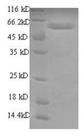 Recombinant Human RNA-binding motif protein, Y chromosome, family 1 member A1 (RBMY1A1), partial – Figure 1 of 1