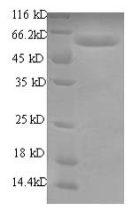 Recombinant Human RNA-binding motif protein, Y chromosome, family 1 member A1 (RBMY1A1), partial – Figure 1 of 1