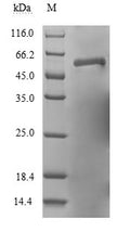 (Tris-Glycine gel) Discontinuous SDS-PAGE (reduced) with 5% enrichment gel and 15% separation gel.