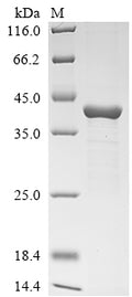 (Tris-Glycine gel) Discontinuous SDS-PAGE (reduced) with 5% enrichment gel and 15% separation gel.
