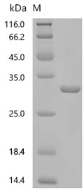 (Tris-Glycine gel) Discontinuous SDS-PAGE (reduced) with 5% enrichment gel and 15% separation gel.