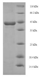 (Tris-Glycine gel) Discontinuous SDS-PAGE (reduced) with 5% enrichment gel and 15% separation gel.