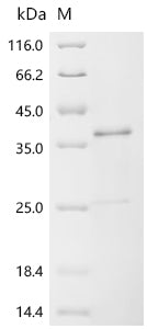 (Tris-Glycine gel) Discontinuous SDS-PAGE (reduced) with 5% enrichment gel and 15% separation gel.
