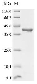 (Tris-Glycine gel) Discontinuous SDS-PAGE (reduced) with 5% enrichment gel and 15% separation gel.