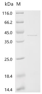 (Tris-Glycine gel) Discontinuous SDS-PAGE (reduced) with 5% enrichment gel and 15% separation gel.