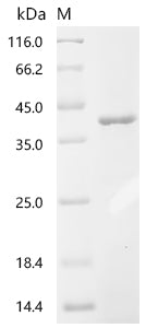 (Tris-Glycine gel) Discontinuous SDS-PAGE (reduced) with 5% enrichment gel and 15% separation gel.