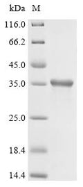 (Tris-Glycine gel) Discontinuous SDS-PAGE (reduced) with 5% enrichment gel and 15% separation gel.