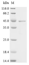 (Tris-Glycine gel) Discontinuous SDS-PAGE (reduced) with 5% enrichment gel and 15% separation gel.