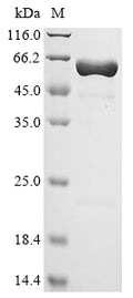 (Tris-Glycine gel) Discontinuous SDS-PAGE (reduced) with 5% enrichment gel and 15% separation gel.