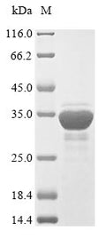 (Tris-Glycine gel) Discontinuous SDS-PAGE (reduced) with 5% enrichment gel and 15% separation gel.