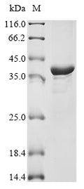 (Tris-Glycine gel) Discontinuous SDS-PAGE (reduced) with 5% enrichment gel and 15% separation gel.
