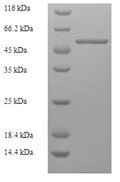 Recombinant Borrelia burgdorferi Flagellar filament 41 kDa core protein (fla) – Figure 1 of 1