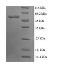 Recombinant Saccharomyces cerevisiae Pyruvate carboxylase 1 (PYC1), partial – Figure 1 of 1