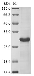 (Tris-Glycine gel) Discontinuous SDS-PAGE (reduced) with 5% enrichment gel and 15% separation gel.