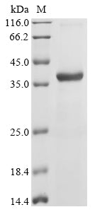 (Tris-Glycine gel) Discontinuous SDS-PAGE (reduced) with 5% enrichment gel and 15% separation gel.