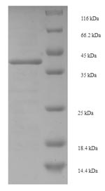 Recombinant Staphylococcus aureus Enterotoxin type E (entE) – Figure 1 of 1