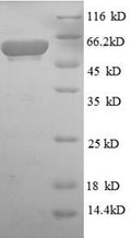 Recombinant Escherichia coli Aerobic glycerol-3-phosphate dehydrogenase (glpD) – Figure 1 of 1