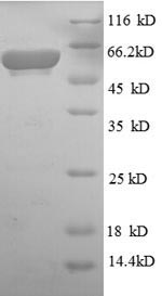 Recombinant Escherichia coli Aerobic glycerol-3-phosphate dehydrogenase (glpD) – Figure 1 of 1