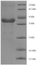 (Tris-Glycine gel) Discontinuous SDS-PAGE (reduced) with 5% enrichment gel and 15% separation gel.