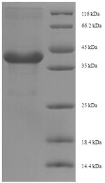 (Tris-Glycine gel) Discontinuous SDS-PAGE (reduced) with 5% enrichment gel and 15% separation gel.