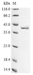 (Tris-Glycine gel) Discontinuous SDS-PAGE (reduced) with 5% enrichment gel and 15% separation gel.