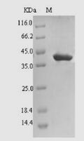 (Tris-Glycine gel) Discontinuous SDS-PAGE (reduced) with 5% enrichment gel and 15% separation gel.