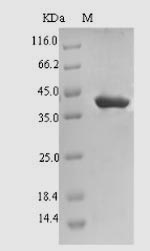 (Tris-Glycine gel) Discontinuous SDS-PAGE (reduced) with 5% enrichment gel and 15% separation gel.