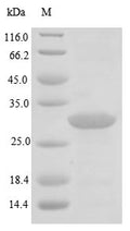(Tris-Glycine gel) Discontinuous SDS-PAGE (reduced) with 5% enrichment gel and 15% separation gel.