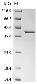(Tris-Glycine gel) Discontinuous SDS-PAGE (reduced) with 5% enrichment gel and 15% separation gel.