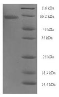 Recombinant Clostridium botulinum Botulinum neurotoxin type A (botA), partial – Figure 1 of 1