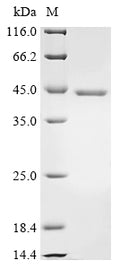 (Tris-Glycine gel) Discontinuous SDS-PAGE (reduced) with 5% enrichment gel and 15% separation gel.