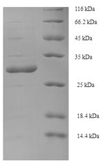 Recombinant Simian immunodeficiency virus Protein Vpx (vpx) – Figure 1 of 1