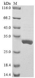 (Tris-Glycine gel) Discontinuous SDS-PAGE (reduced) with 5% enrichment gel and 15% separation gel.